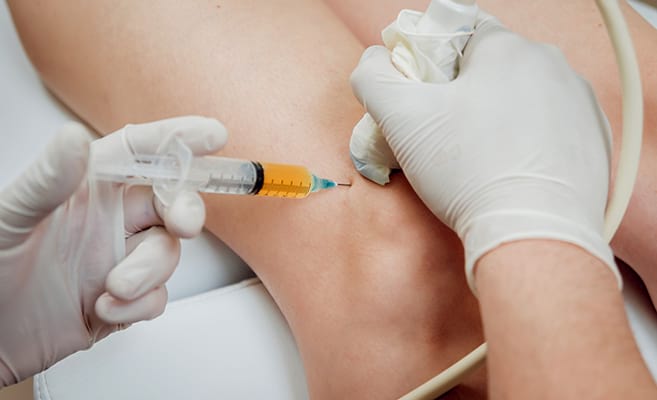 The concentrated PRP is injected at the injury site with ultrasound guidance
