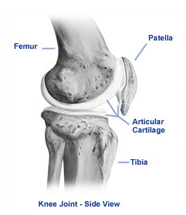 Articular Cartilage Tear